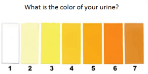 Color-of-urine-500x320